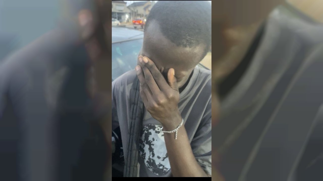 Soutien à notre frère qui perd ses cheveux